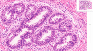 Microscopic view of glandular tissue
